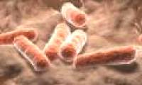 Bowel carotenoids are related to stroke