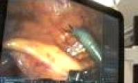 Brain discovery in the ovaries of 16-year-old girls