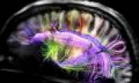 Brain structure changes during exams
