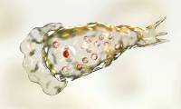 Brain-Eating Amoeba: Causes, Symptoms, and Treatment