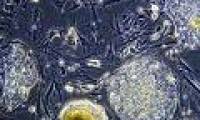 Breakthroughs in research on