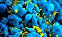 British men may be the first to be cured of HIV through new therapies