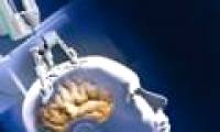 Burning laser brain tumors