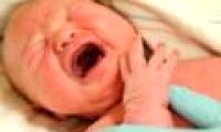 Caesarean babies are allergic