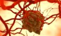 Cancer cells spread in the body in a more frightening way than you think