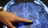Cancer drug prevents transplant rejection