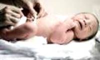 Care of newborn umbilical cord