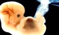 Childbirth with sister's ovaries