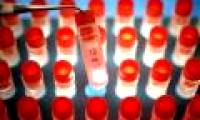 China: Many people die from stem cell therapy