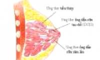 Cleansing products increase the risk of breast cancer