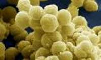 Close up of beautiful deadly bacteria surprised