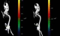 Close-up of the life-and-death battle inside the body