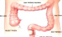 Colorectal cancer: Symptoms, causes and prevention