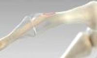 Connect the bones of the screw made from ... human bones