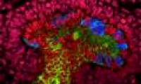 Create mini kidneys from stem cells