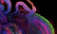 Create tiny brain from human skin