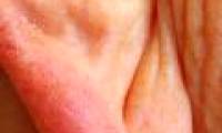 Crossbones in the earlobe warn of cardiovascular disease