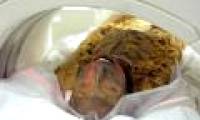 CT scan to find the sex of the mummy
