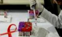 Cuban researchers tested the HIV / AIDS vaccine