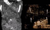 Decipher the mystery of how to preserve the fetus in a 2,000-year-old Egyptian mummy