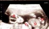 Decode the phenomenon of natural pregnancy