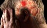Decode the 'stroke shield' of the brain