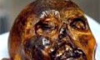 Dental examination for mummies