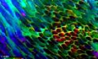 Detect special structure in human tooth enamel