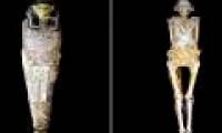 Detected 2,200-year-old mummy with obesity caused by eating a lot of sugar