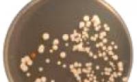 Detecting bacterial 'forest' in human navel