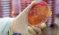 Detecting deadly drug-resistant virus in Australia