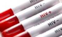 Detecting drugs that treat lung cancer can kill HIV cells