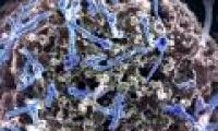 Detecting Ebola virus in spermatozoa who got sick 9 months earlier