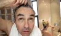 Detecting protein causes baldness in men