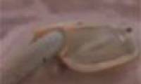 Detecting tadpole originated 200 million years