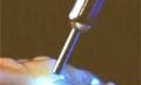 Detection of cancer by Raman laser