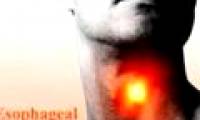 Detection of gene variants causing esophageal cancer