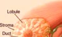 Detection of genetic modification factors for breast cancer