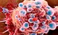 Detects aging-causing substances in cancer cells