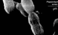 Detects bacteria that cause infections