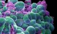 Determining the gene causes breast cancer cells to spread