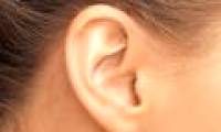 Determining the type of protein can help people with hearing loss hear back to normal