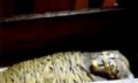 Diagnosis of appendicitis for mummies 2100 years old