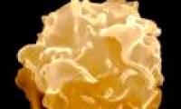 Discover 'natural killer' in the body