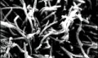 Discover new bacteria that cause dental disease