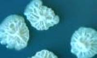 Discover shock about bacterial growth in space