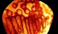 Discover the largest, oldest sperm