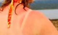 Discover two new gene variants that cause malignant skin cancer