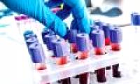 Discovering extremely ugly 'ugly' cholesterol