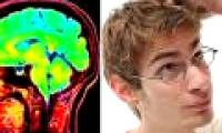 Disease affects IQ the most